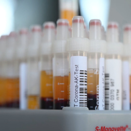 El coronavirus deja más de 23,2 millones de casos a nivel mundial