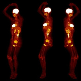 : Varias imágenes de un cuerpo humano completo obtenidas por el nuevo escáner Explorer./UCDAVIS/UNITED IMAGING