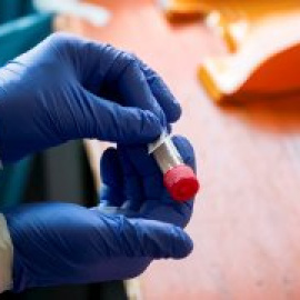 Sanidad notifica 23.000 nuevos contagios desde el viernes, de los cuales más de 7.000 se han registrado en Madrid