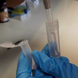 Test rápido de tipo Point-of-care (POC) basado en nanosistemas con puertas moleculares - UPV - EUROPA PRESS