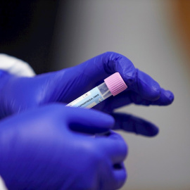 Una prueba PCR, en una imagen de archivo. / EFE - Manu Reino