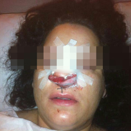 Denuncia de torturas