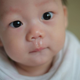 Bebé con mocos.