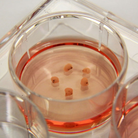 Organoides cerebrales humanos en cultivo en una placa de Petri.