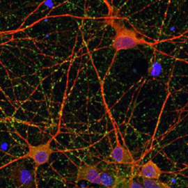 Imágenes de microscopía de cultivos de células neuronales. IBB-CSIC.