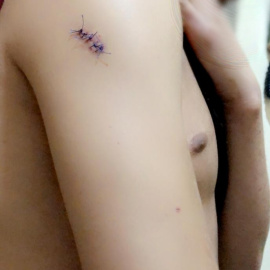 Agresión homófoba a un refugiado en Vallecas