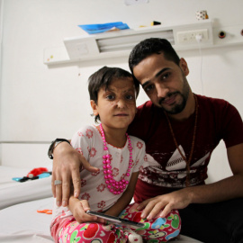 Noor y Salah llegaron al centro en septiembre de 2016. Una explosión en Fallujah dejó a la pequeña graves heridas en rostro y cabeza. - MARÍA GONZÁLEZ