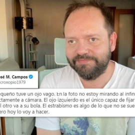 El hilo viral sobre estrabismo y famosos que lo padecen