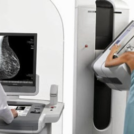 Educar en la autoexploración y mamografías más precisas son clave para prevenir el cáncer de mama