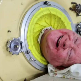 Paul Alexander, un hombre que ha vivido encerrado en un pulmón de acero durante más de siete décadas, ha fallecido a los 78 años