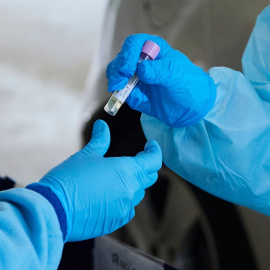 28/12/2021 Una enfermera da una muestra de PCR para su análisis