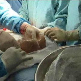 España está a la cabeza de donantes del mundo