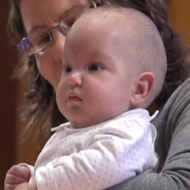 Primer feto operado de espina bífida con un parche