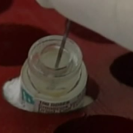 España supera los 60 casos, entre confirmados y sospechosos, de viruela del mono