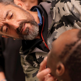 El cirujano Pedro Cavadas observa la cara de Emmanuelle, el niño congoleño de 10 años al que ha extirpado un tumor cráneo facial no maligno | EFE