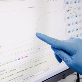 Pantalla de un ordenador con resultados positivos de viruela del mono, en el Hospital Ramón y Cajal, a 30 de mayo de 2022, en Madrid (España).