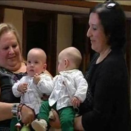 Separadas dos siamesas unidas por el abdomen y el hígado