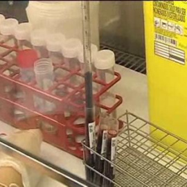 Localizan la molécula por la que se propaga el virus del SIDA