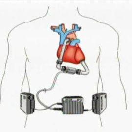 El día a día con un corazón de titanio