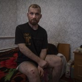 La odisea de sobrevivir al cáncer en medio de la guerra