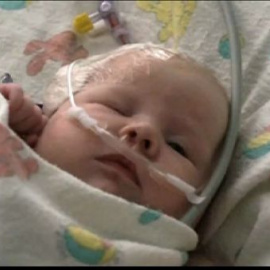 El Super Glue salva a un bebé en Estados Unidos