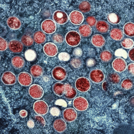 09/08/2022. Una micrografía electrónica de transmisión de partículas del virus de la viruela símica, a 4 de agosto de 2022.