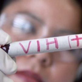 El avance abre la puerta a diseñar nuevos tratamientos para curar el Sida - EFE