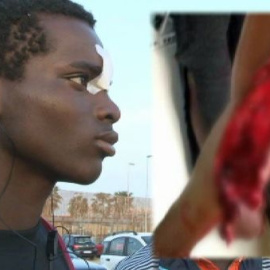 Una concertina le desgarró un brazo en su salto a la valla de Melilla