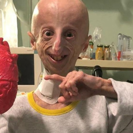El biólogo molecular y enfermo de progeria, Sammy Basso (Facebook / Sammy Basso)