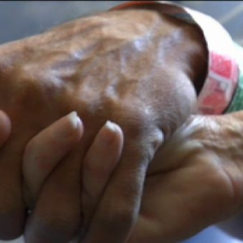 La Sanidad española consigue la mayor cadena de trasplantes en vivo