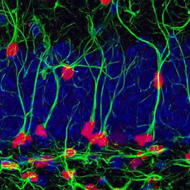 Tinción de células madre neurales en un hipocampo de ratón macho adulto / Patricia Tezanos, Kerry R. McGreevy, José L. Trejo