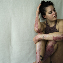 Lena tiene 25 años y trabaja en el equipo de Debra Austria después de haber pasado 14 meses en Marbella colaborando con la asociación. / LETICIA PELLICER