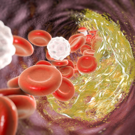 Ilustración del colesterol que circula por una arteria./SUT