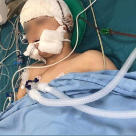 Abdul en el hospital de Nablus momentos después de ser operado.