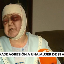 Valentina Sánchez, de 91 años, paseaba por la calle cuando un hombre, al que no conocía de nada, la atacó de forma violenta con una barra metálica./ ANTENA 3
