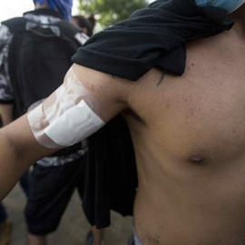 Un joven recibe un disparo de balines por personas desconocidas durante el día número 45 de protestas en contra del gobierno de Daniel Ortega. EFE Jorge Torres