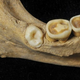 Identifican restos humanos en Atapuerca con un molar de más. /JORDI MESTRE