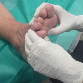 Revisión del p ie diabético. /Instituto Valenciano del Pie