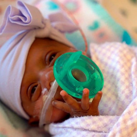 Saybie en marzo de 2019, cuando pesaba 1,3 kilos./ Sharp HealthCare