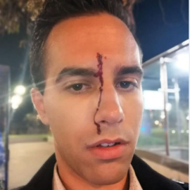 Imatge que ha penjat un dels joves agredits. @xmartinezvidal