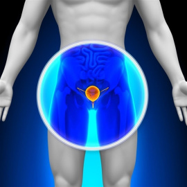 Un medicamento muestra mejoras en el tratamiento del cáncer de vejiga. /GETTY