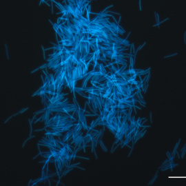 Metanobacterias encontradas en sedimentos marinos, vistas al microscopio de fluorescencia./ JAMSTEC