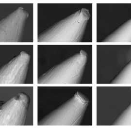 Desgaste de tres agujas de tatuar vistas al microscopio electrónico. A la izquierda nuevas, en el centro tras inyectar tinta de carbón y a la derecha muy afiladas por el dióxido de titanio.- ESRF