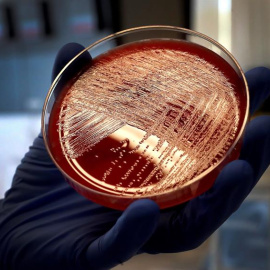 12/09/2019.- Vista de un cultivo de listeriosis en una placa de Petri, este jueves en el Laboratorio de Listeriosis del Centro Nacional de Microbiología de Madrid. Investigadores del Centro Nacional de Microbiología (CNM) han confirmado que