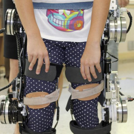 Demostración del prototipo biónico creado por Marsi-Bionics./ EFE/Alan Neil