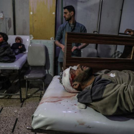 Gente herida tratada en el hospital de Douma, de Ghuta Oriental, un suburbio de Damasco. EFE/EPA/MOHAMMED BADRA