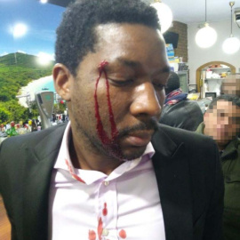 Marius Makon tras ser agredido por la clienta de un bar en Móstoles.