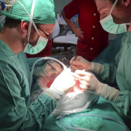 Fotografía facilitada por el hospital de La Paz del primer trasplante pulmonar infantil. EFE/Archivo