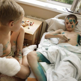 Tres muchachos resultaron heridos en Donetsk por culpa de una granada, que se mantenía sin detonar, mientras jugaban cerca de casa. EFE