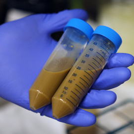 Muestras de heces para la operación de trasplante de microbiota fecal.